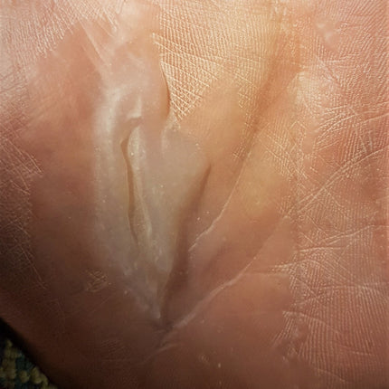 Siliconesandmore Silicone Wound